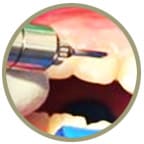 gumrecontouringicon