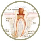 rootcanalicon