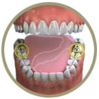 silverfillingsicon