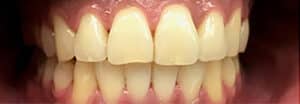 After Image: Orthodontics