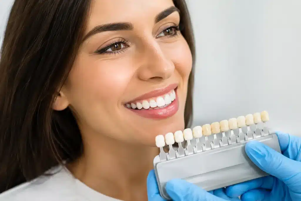 Are Veneers Permanent Teeth? What to Know